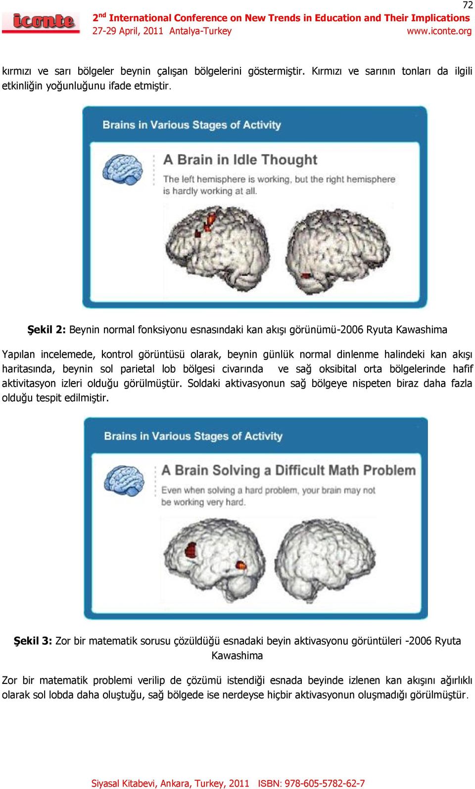 beynin sol parietal lob bölgesi civarında ve sağ oksibital orta bölgelerinde hafif aktivitasyon izleri olduğu görülmüştür.