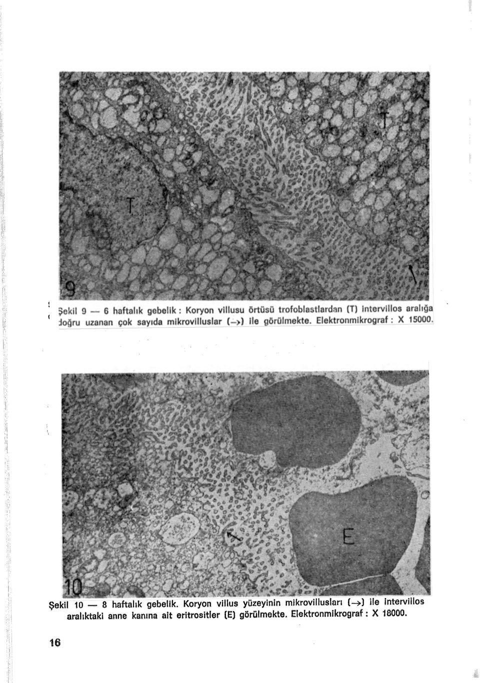 Elektronmikrograf: X 15000. : ıii 'I Şekil 10-8 haftalık gebelik.