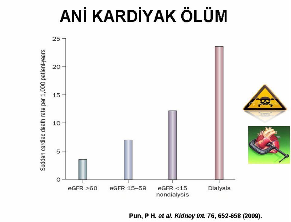 Chronic kidney disease