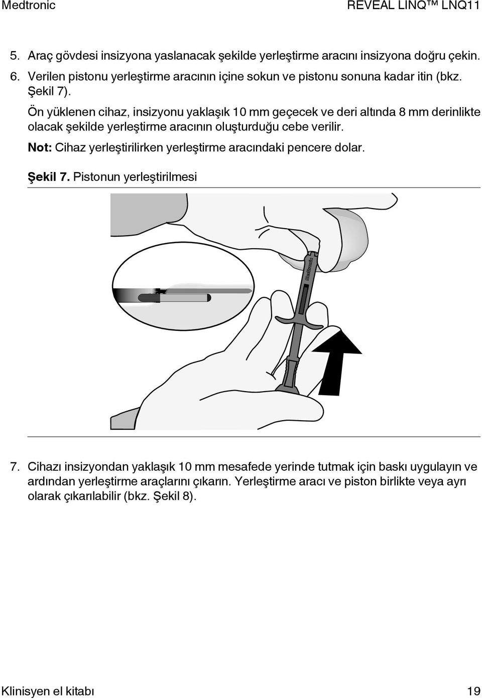 Ön yüklenen cihaz, insizyonu yaklaşık 10 mm geçecek ve deri altında 8 mm derinlikte olacak şekilde yerleştirme aracının oluşturduğu cebe verilir.