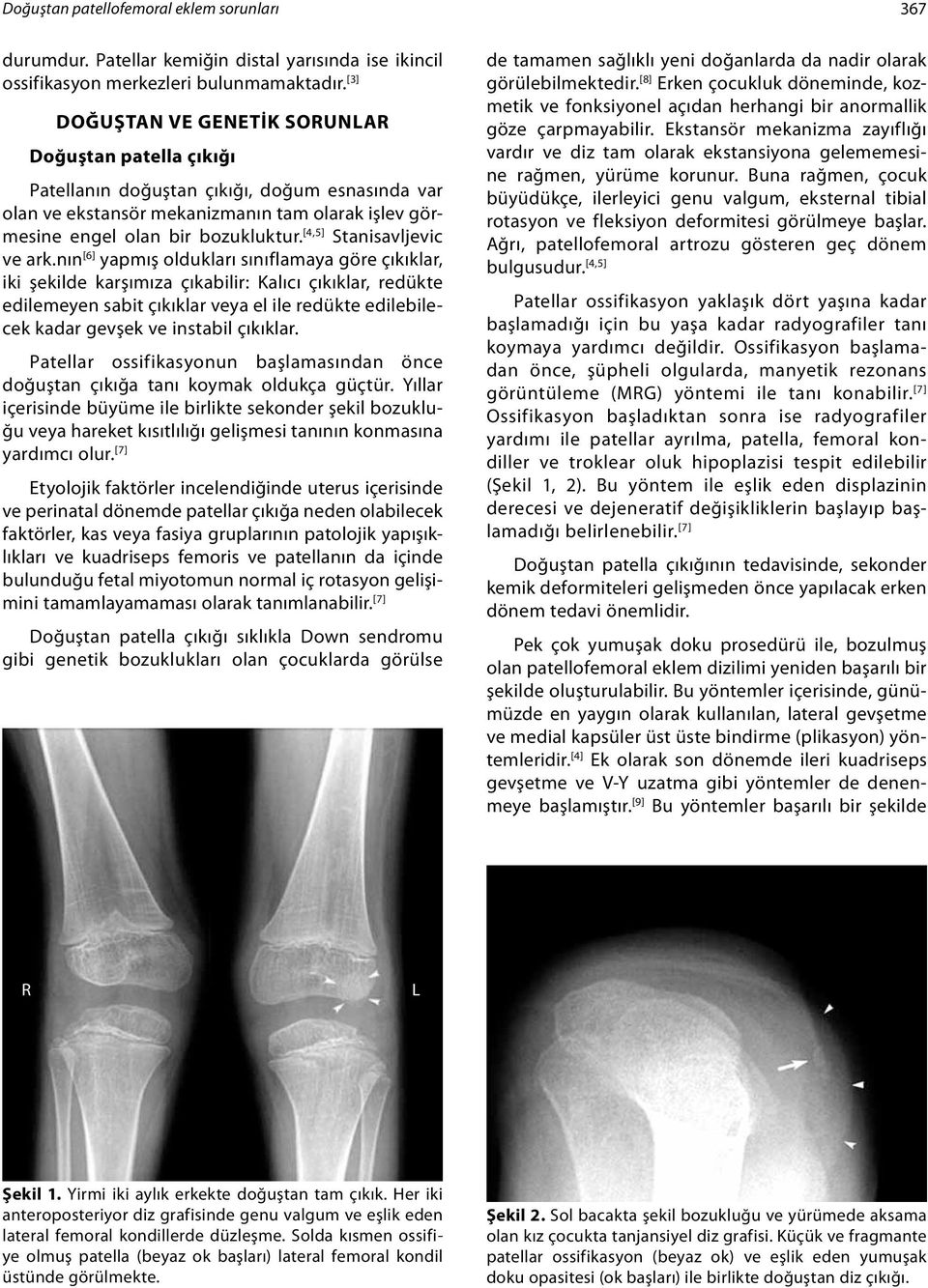 [4,5] Stanisavljevic ve ark.