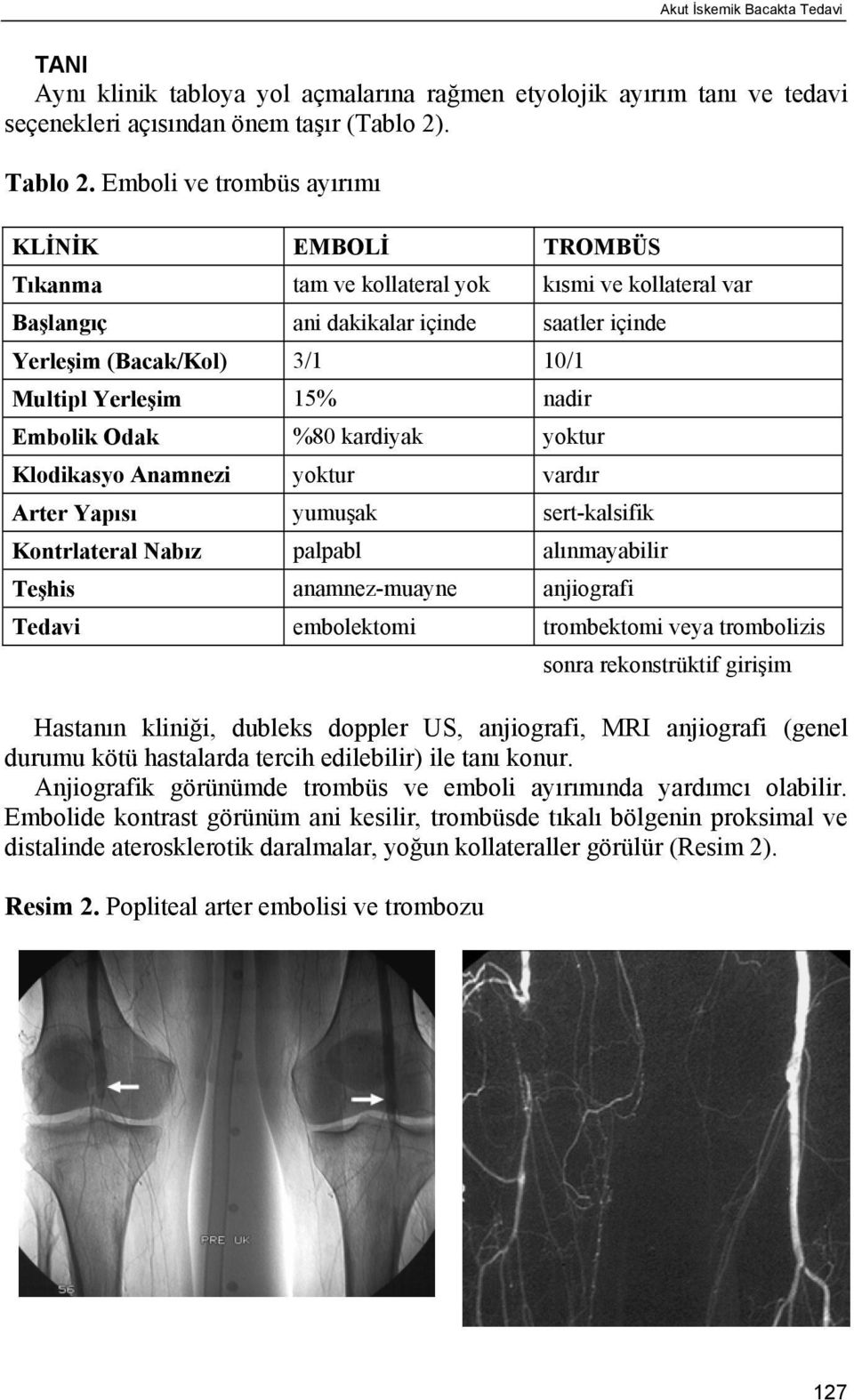 nadir Embolik Odak %80 kardiyak yoktur Klodikasyo Anamnezi yoktur vardır Arter Yapısı yumuşak sert-kalsifik Kontrlateral Nabız palpabl alınmayabilir Teşhis anamnez-muayne anjiografi Tedavi