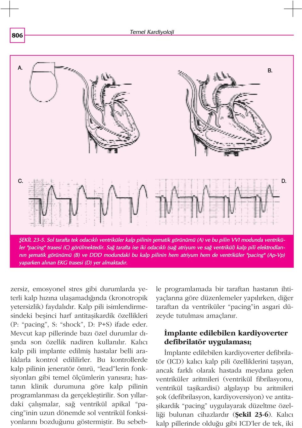 nan EKG trasesi (D) yer almaktad r. zersiz, emosyonel stres gibi durumlarda yeterli kalp h z na ulaflamad nda (kronotropik yetersizlik) faydal d r.