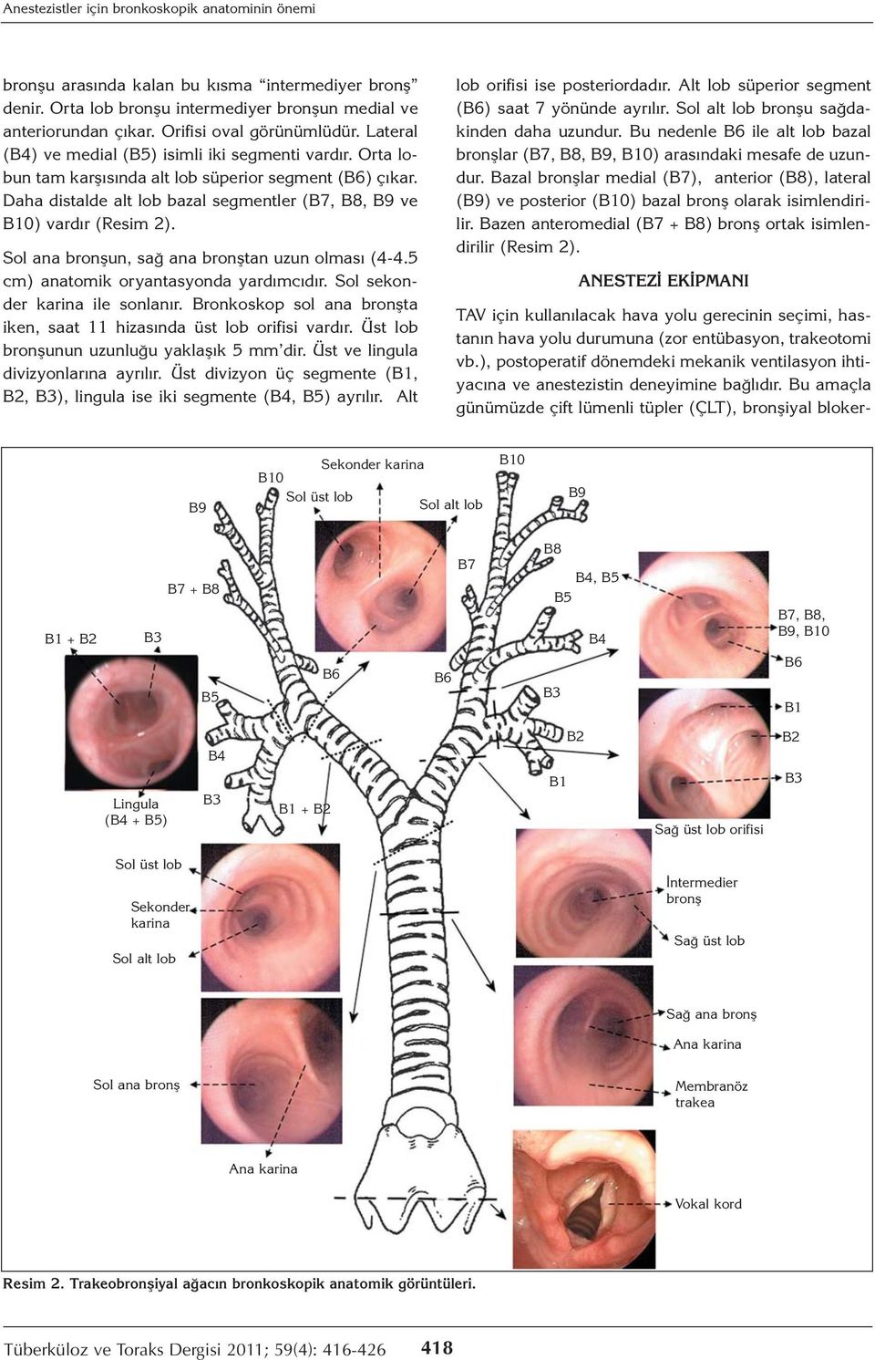 Sol ana bronşun, sağ ana bronştan uzun olması (4-4.5 cm) anatomik oryantasyonda yardımcıdır. Sol sekonder karina ile sonlanır. ronkoskop sol ana bronşta iken, saat 11 hizasında üst lob orifisi vardır.