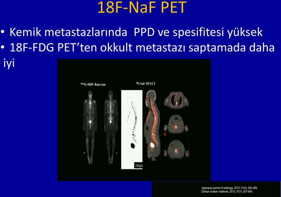 spesifitesi yüksek 18F-FDG