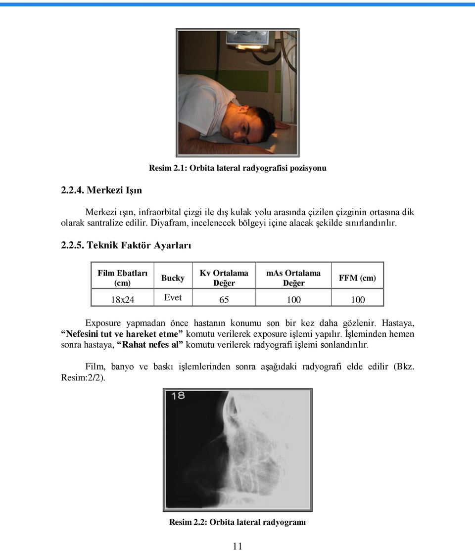 Teknik Faktör Ayarları Film Ebatları (cm) Bucky Kv Ortalama Değer mas Ortalama Değer FFM (cm) 18x24 Evet 65 100 100 Exposure yapmadan önce hastanın konumu son bir kez daha gözlenir.