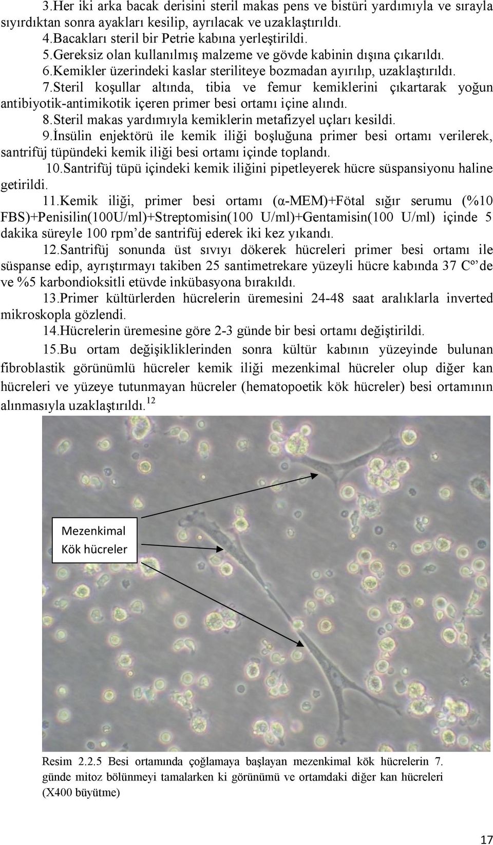 Steril koşullar altında, tibia ve femur kemiklerini çıkartarak yoğun antibiyotik-antimikotik içeren primer besi ortamı içine alındı. 8.Steril makas yardımıyla kemiklerin metafizyel uçları kesildi. 9.