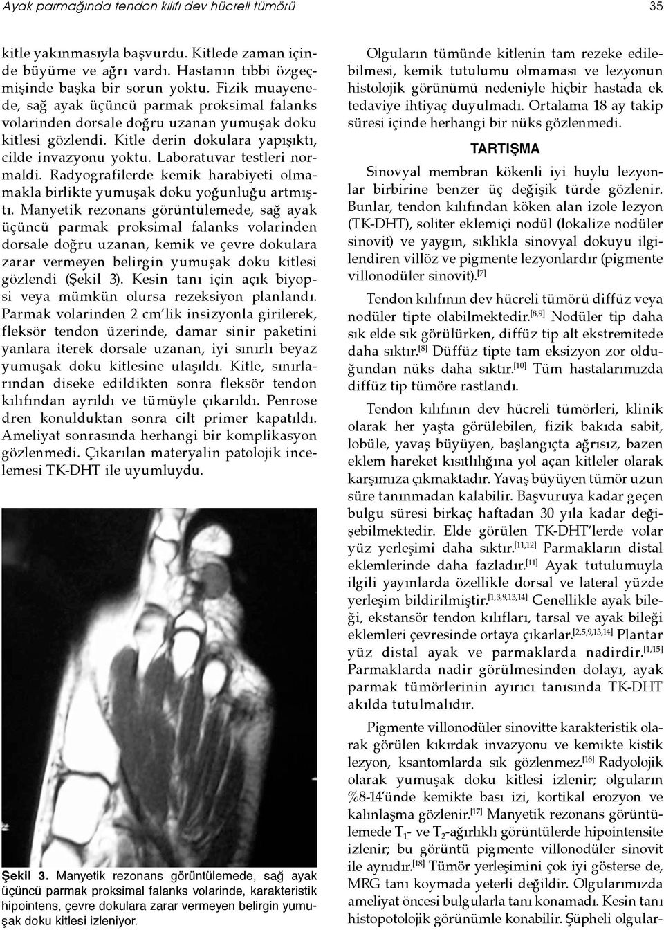 Laboratuvar testleri normaldi. Radyografilerde kemik harabiyeti olmamakla birlikte yumuşak doku yoğunluğu artmıştı.