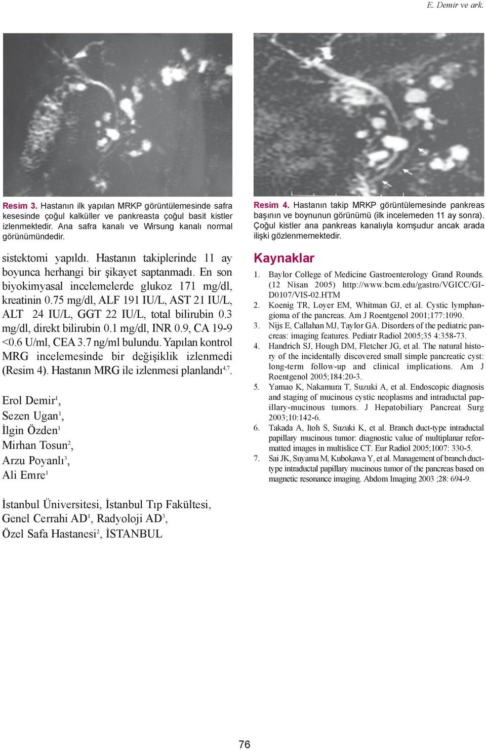 En son biyokimyasal incelemelerde glukoz 171 mg/dl, kreatinin 0.75 mg/dl, ALF 191 IU/L, AST 21 IU/L, ALT 24 IU/L, GGT 22 IU/L, total bilirubin 0.3 mg/dl, direkt bilirubin 0.1 mg/dl, INR 0.