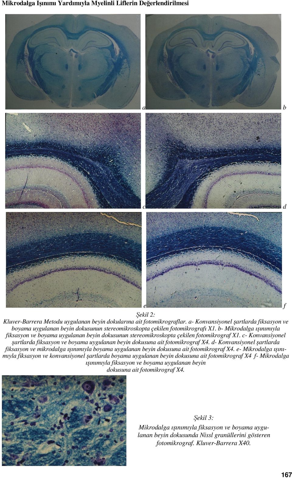 b- Mikrodalga ışınımıyla fiksasyon ve boyama uygulanan beyin dokusunun stereomikroskopta çekilen fotomikrograf X1.