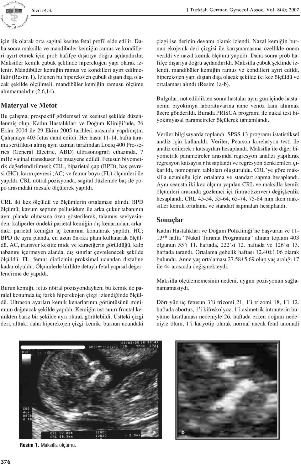 Mandibüler kemi in ramus ve kondilleri ay rt edilmelidir (Resim 1). zlenen bu hiperekojen çubuk d fltan d fla olacak flekilde ölçülmeli, mandibüler kemi in ramusu ölçüme al nmamal d r (2,,1).