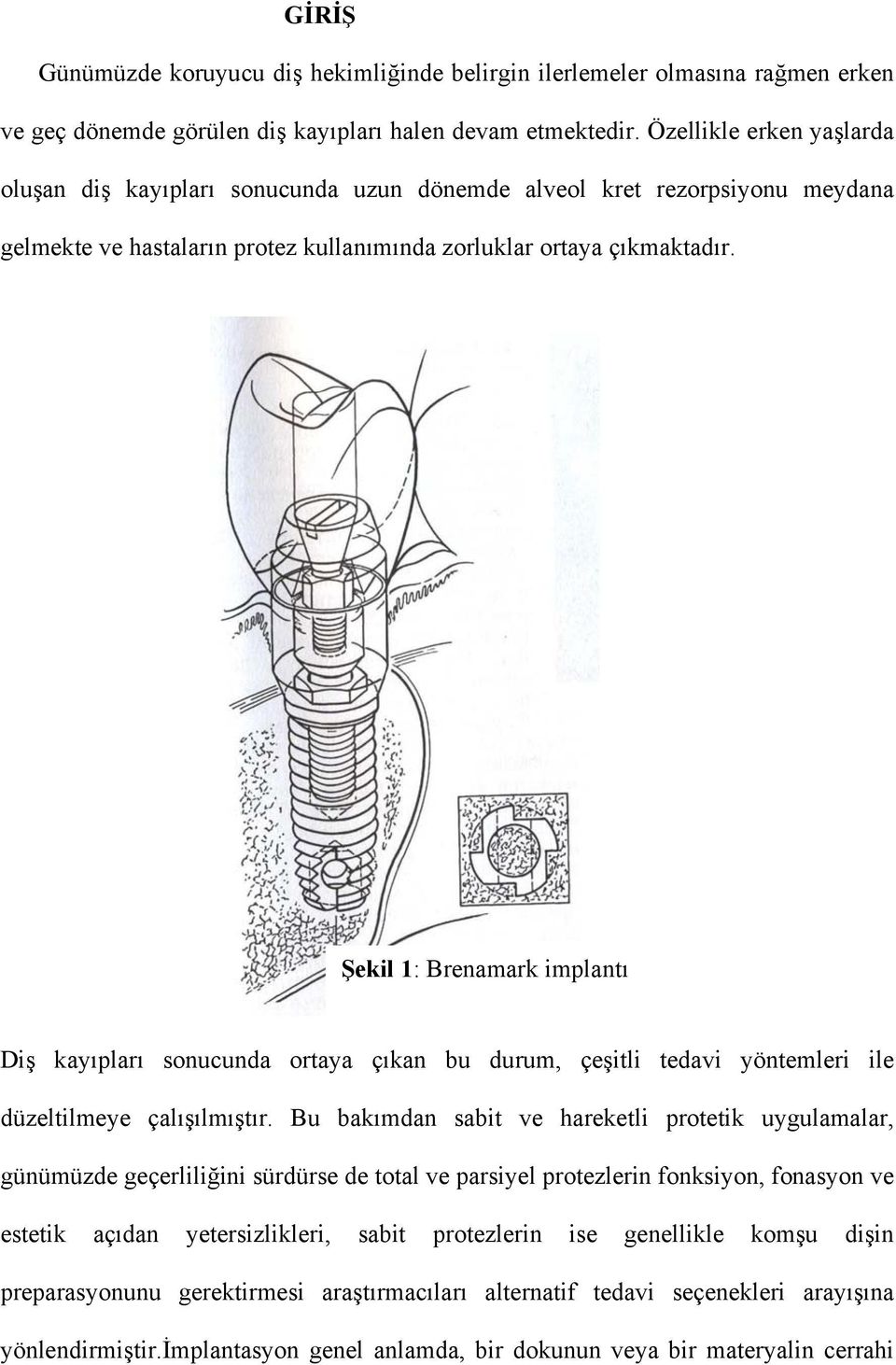 Şekil 1: Brenamark implantı Diş kayıpları sonucunda ortaya çıkan bu durum, çeşitli tedavi yöntemleri ile düzeltilmeye çalışılmıştır.