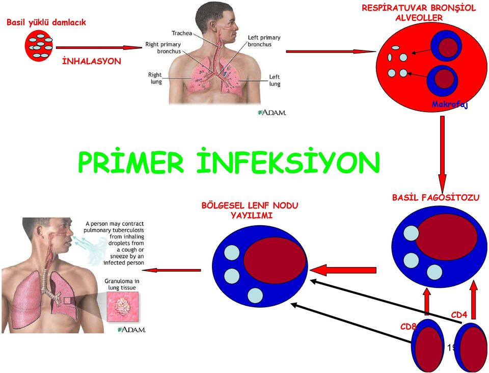 Makrofaj PRİMER İNFEKSİYON BÖLGESEL