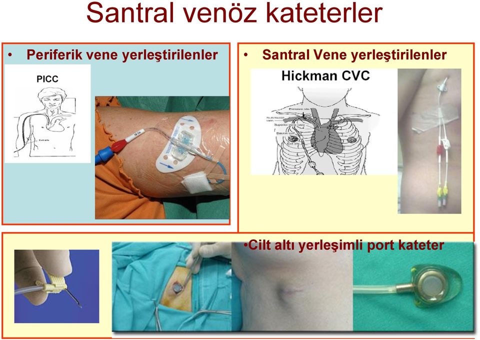 yerleştirilenler Santral Vene