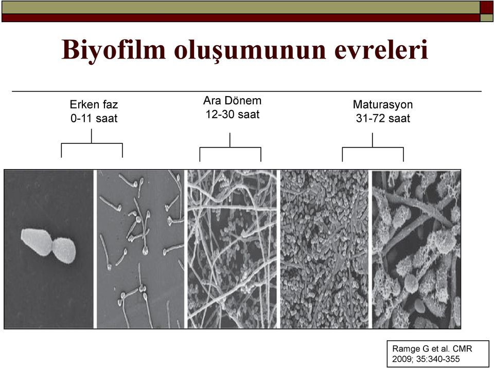 12-30 saat Maturasyon 31-72