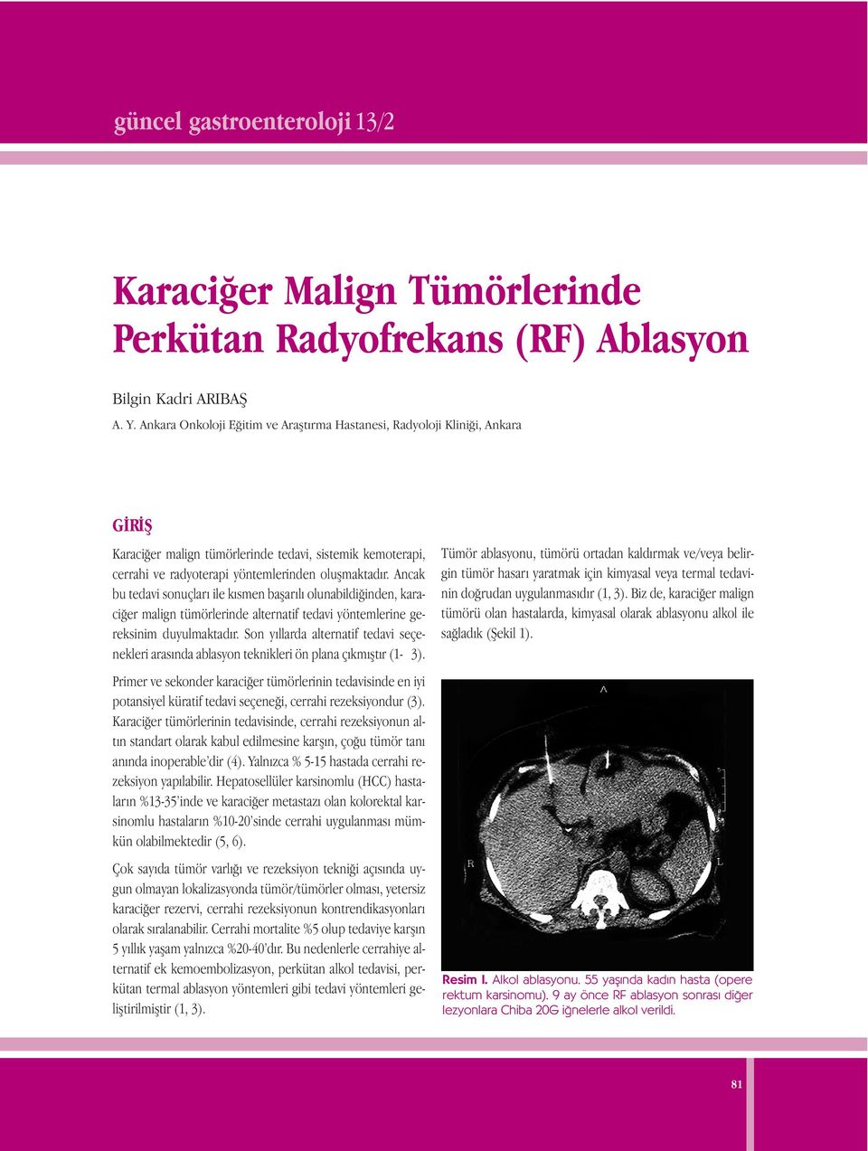 Ancak bu tedavi sonuçları ile kısmen başarılı olunabildiğinden, karaciğer malign tümörlerinde alternatif tedavi yöntemlerine gereksinim duyulmaktadır.