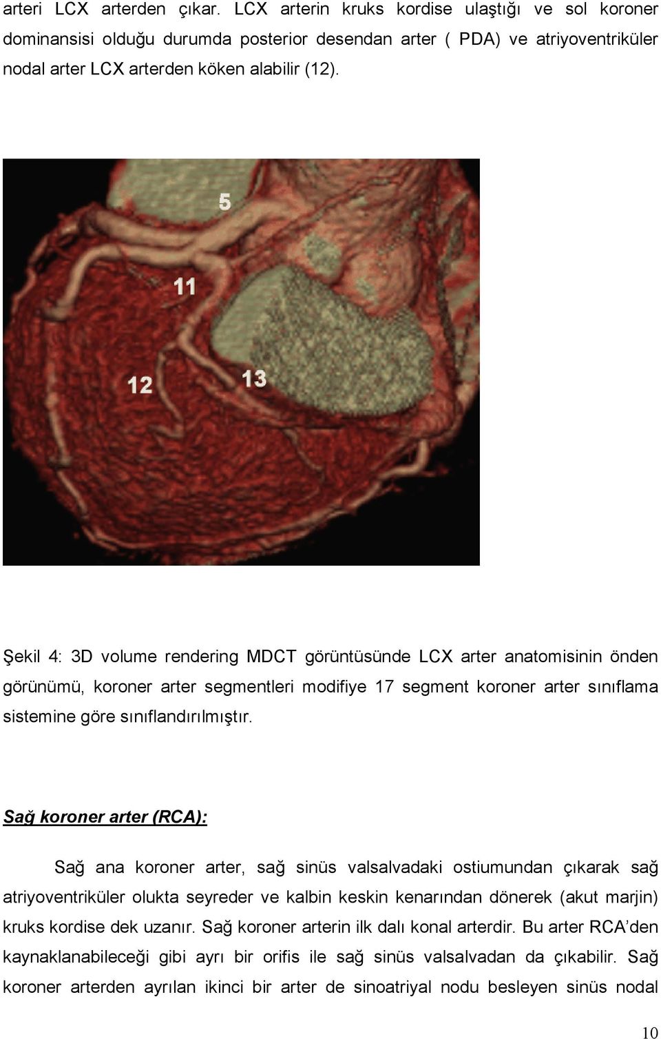 Şekil 4: 3D volume rendering MDCT görüntüsünde LCX arter anatomisinin önden görünümü, koroner arter segmentleri modifiye 17 segment koroner arter sınıflama sistemine göre sınıflandırılmıştır.