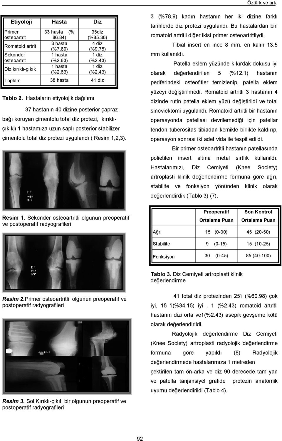 43) Toplam 38 hasta 41 diz 37 hastanın 40 dizine posterior çapraz bağı koruyan çimentolu total diz protezi, kırıklıçıkıklı 1 hastamıza uzun saplı posterior stabilizer çimentolu total diz protezi