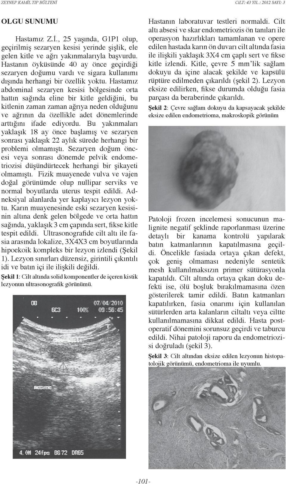 Hastamız abdominal sezaryen kesisi bölgesinde orta hattın sağında eline bir kitle geldiğini, bu kitlenin zaman zaman ağrıya neden olduğunu ve ağrının da özellikle adet dönemlerinde arttığını ifade