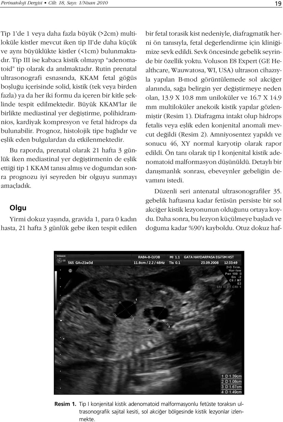 Rutin prenatal ultrasonografi esnas nda, KKAM fetal gö üs bofllu u içerisinde solid, kistik (tek veya birden fazla) ya da her iki formu da içeren bir kitle fleklinde tespit edilmektedir.