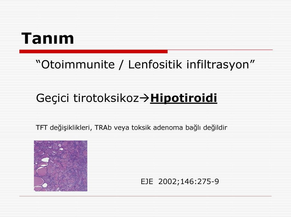 Hipotiroidi TFT değişiklikleri, TRAb