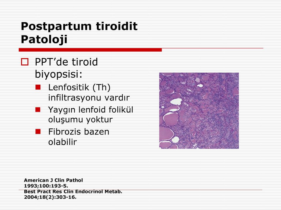 oluşumu yoktur Fibrozis bazen olabilir American J Clin Pathol