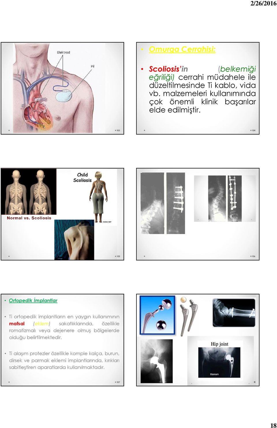 103 104 105 106 Ortopedik İmplantlar Ti ortopedik implantların en yaygın kullanımının mafsal (eklem) sakatlıklarında, özellikle