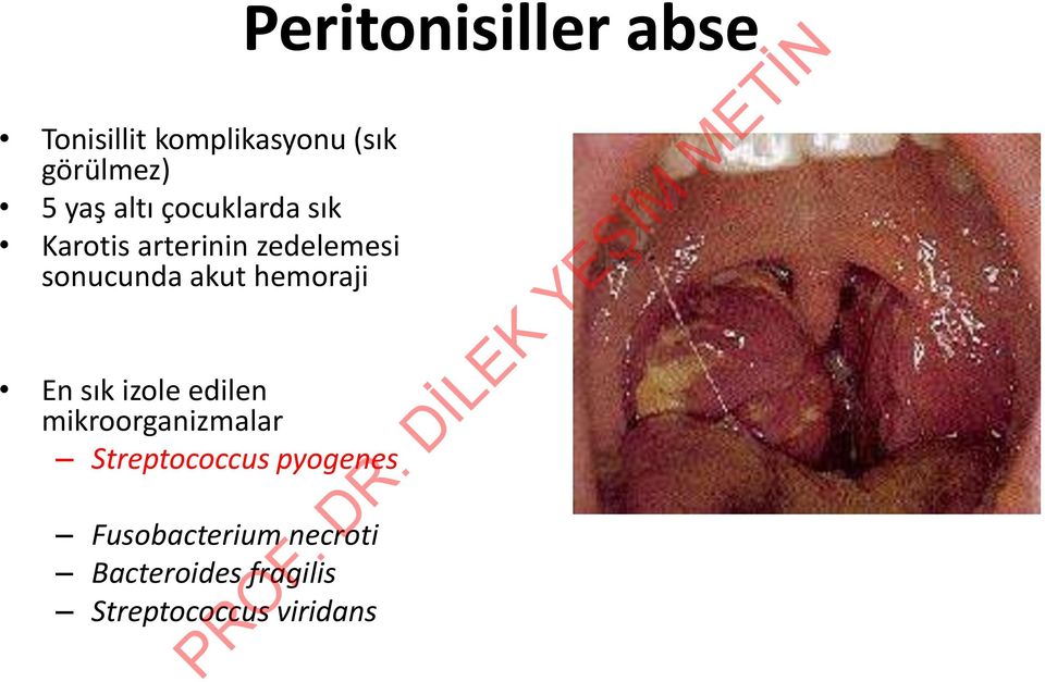 edilen mikroorganizmalar Streptococcus pyogenes Fusobacterium