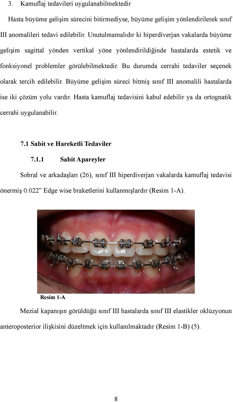 Bu durumda cerrahi tedaviler seçenek olarak tercih edilebilir. Büyüme gelişim süreci bitmiş sınıf III anomalili hastalarda ise iki çözüm yolu vardır.