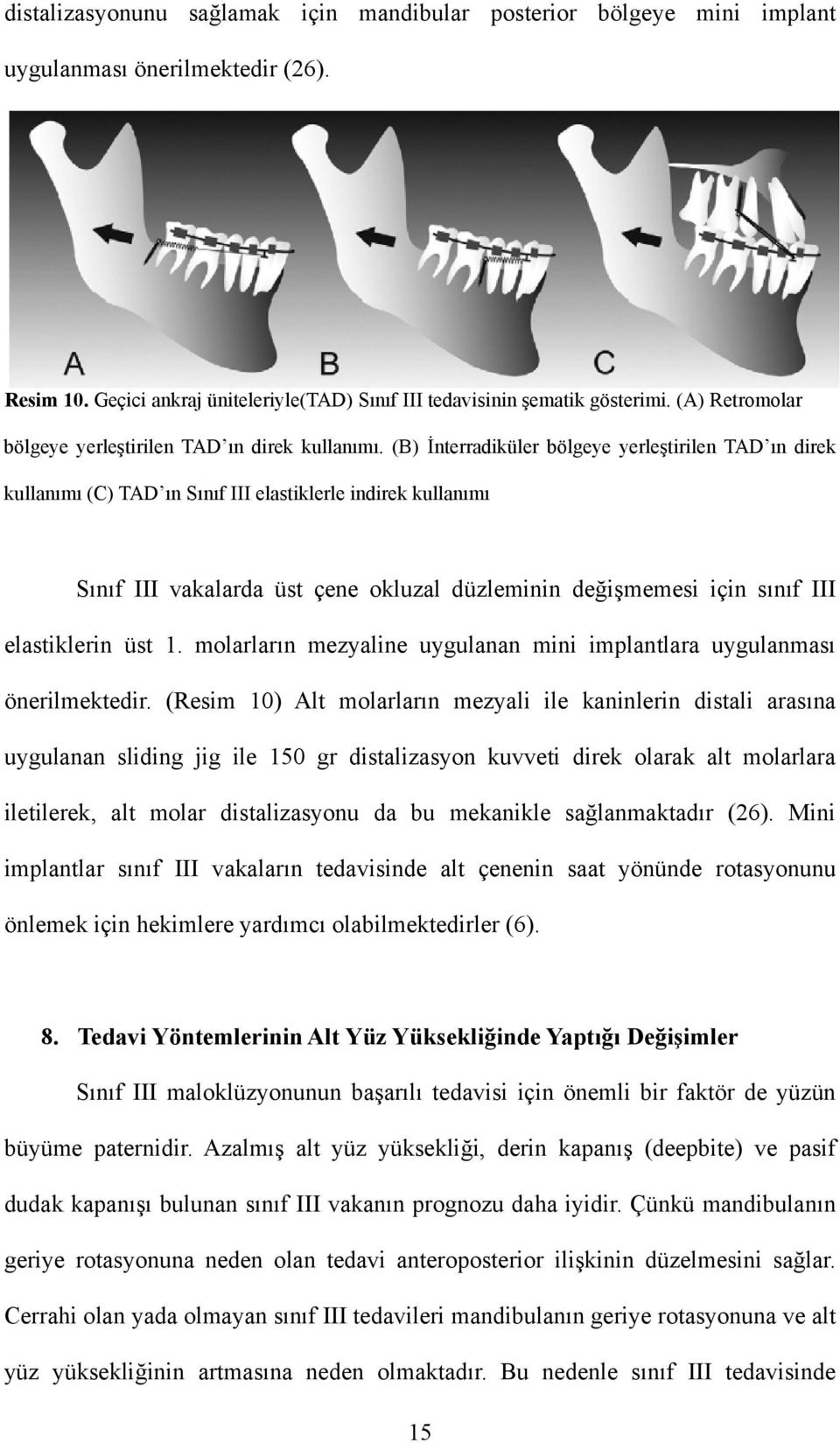 (B) İnterradiküler bölgeye yerleştirilen TAD ın direk kullanımı (C) TAD ın Sınıf III elastiklerle indirek kullanımı Sınıf III vakalarda üst çene okluzal düzleminin değişmemesi için sınıf III