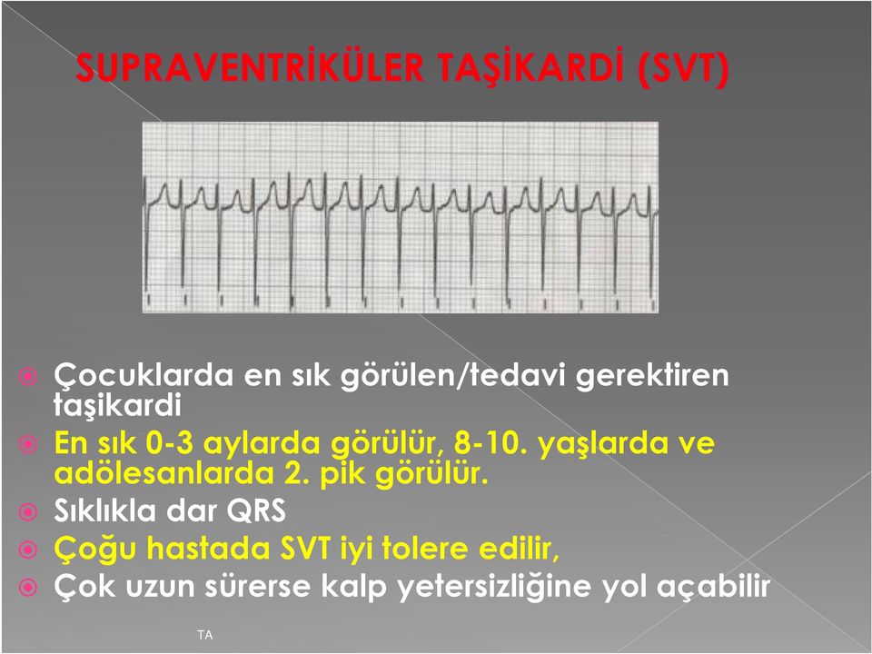 Sıklıkla dar QRS Çoğu hastada SVT iyi tolere edilir, Çok uzun