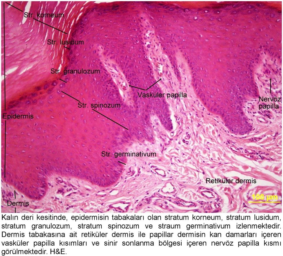 Dermis tabakasına ait retiküler dermis ile papillar dermisin kan damarları içeren