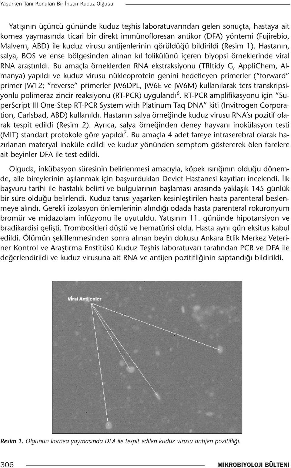 Hastanın, salya, BOS ve ense bölgesinden alınan kıl folikülünü içeren biyopsi örneklerinde viral RNA araştırıldı.