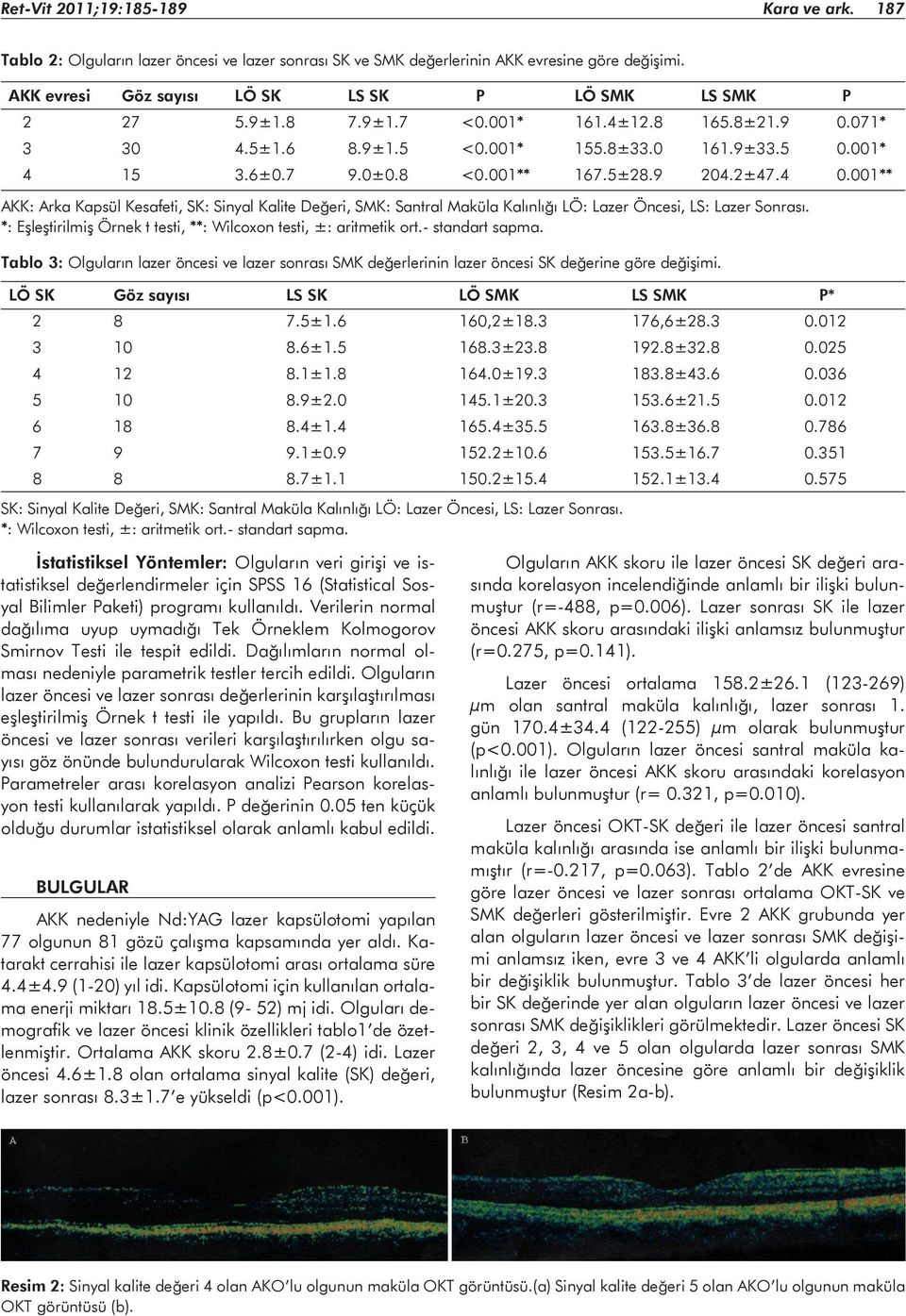 001** AKK: Arka Kapsül Kesafeti, SK: Sinyal Kalite Değeri, SMK: Santral Maküla Kalınlığı LÖ: Lazer Öncesi, LS: Lazer Sonrası. *: Eşleştirilmiş Örnek t testi, **: Wilcoxon testi, ±: aritmetik ort.