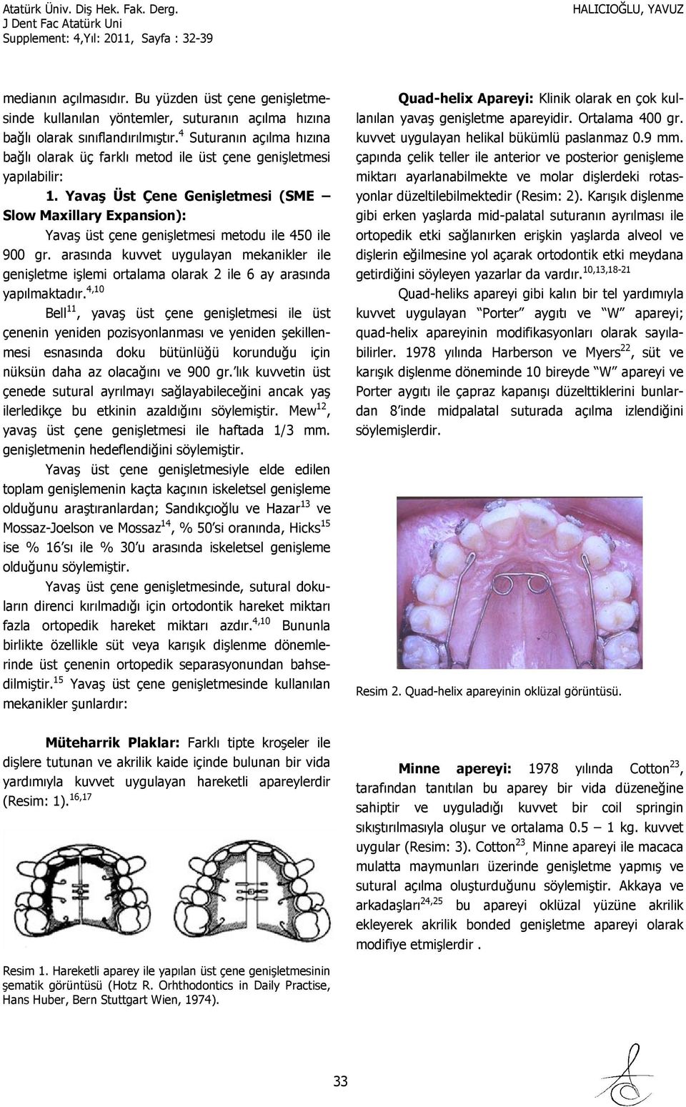 Yavaş Üst Çene Genişletmesi (SME Slow Maxillary Expansion): Yavaş üst çene genişletmesi metodu ile 450 ile 900 gr.