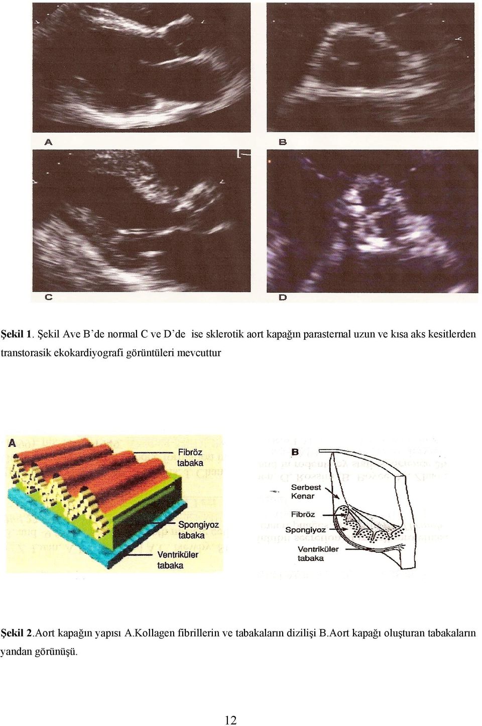 uzun ve kısa aks kesitlerden transtorasik ekokardiyografi görüntüleri