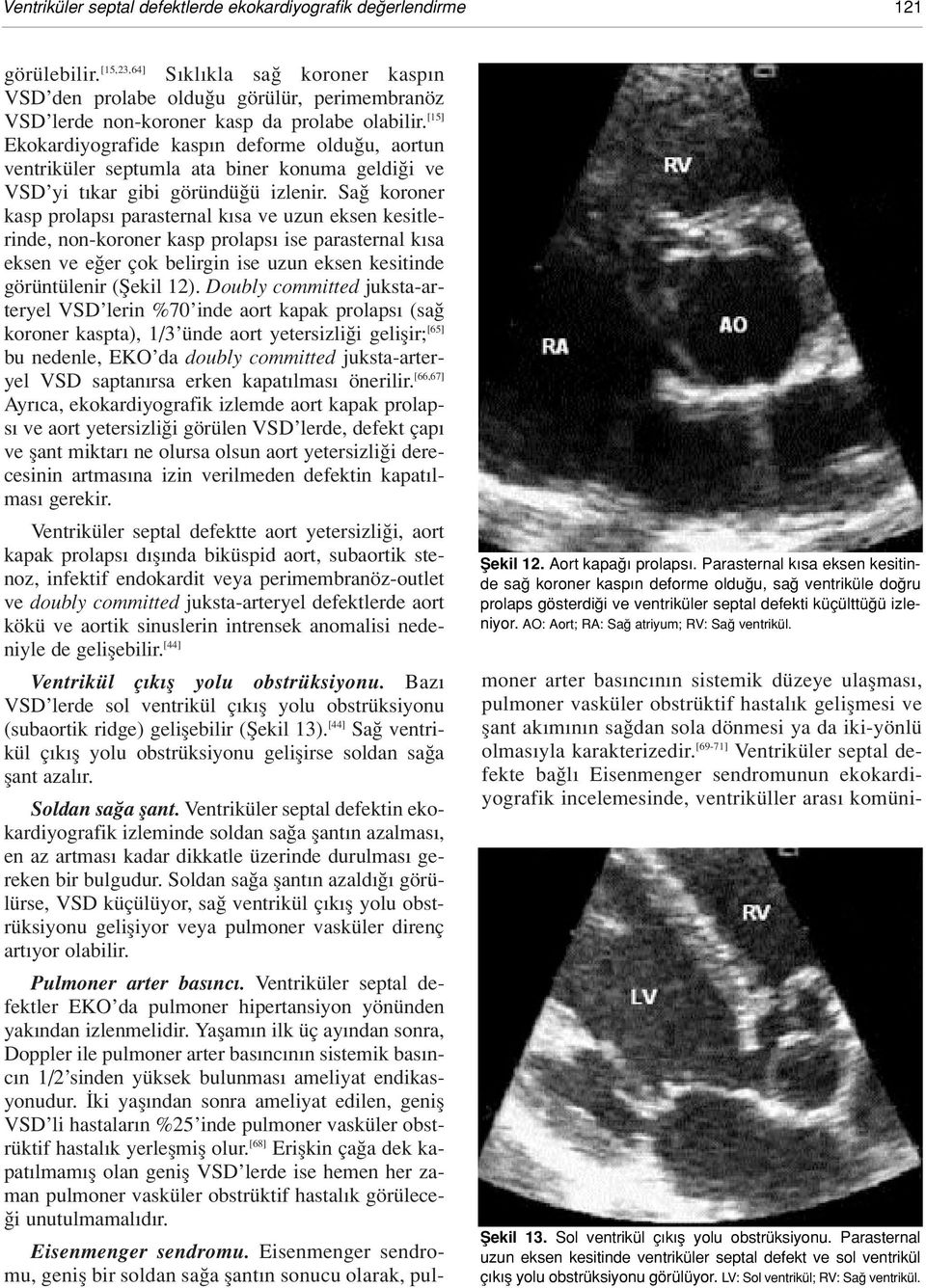 Parasternal k sa eksen kesitinde sa koroner kasp n deforme oldu u, sa ventriküle do ru prolaps gösterdi i ve ventriküler septal defekti küçülttü ü izleniyor.