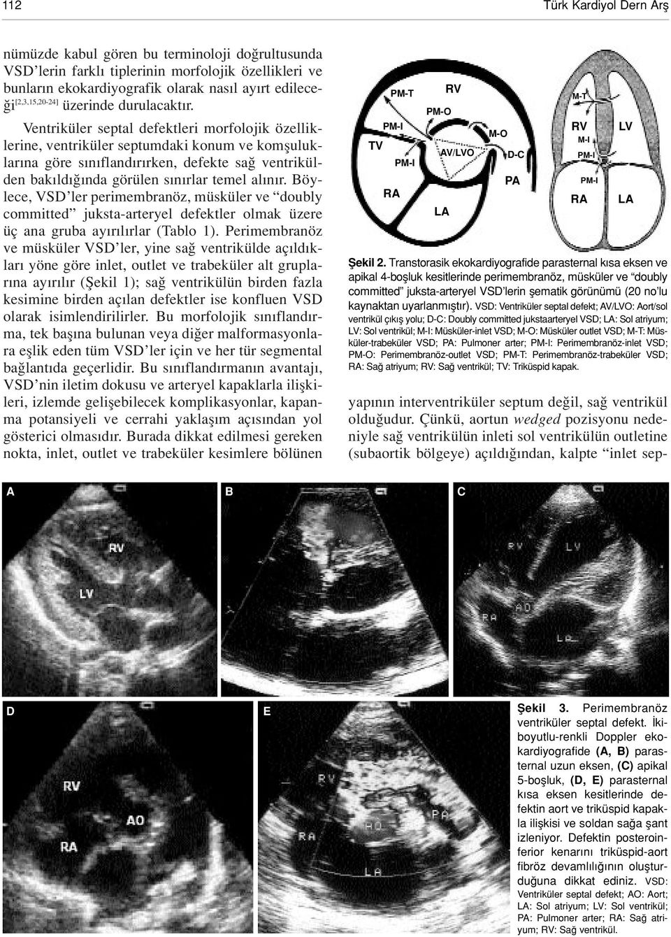 Ventriküler septal defektleri morfolojik özelliklerine, ventriküler septumdaki konum ve komfluluklar na göre s n fland r rken, defekte sa ventrikülden bak ld nda görülen s n rlar temel al n r.