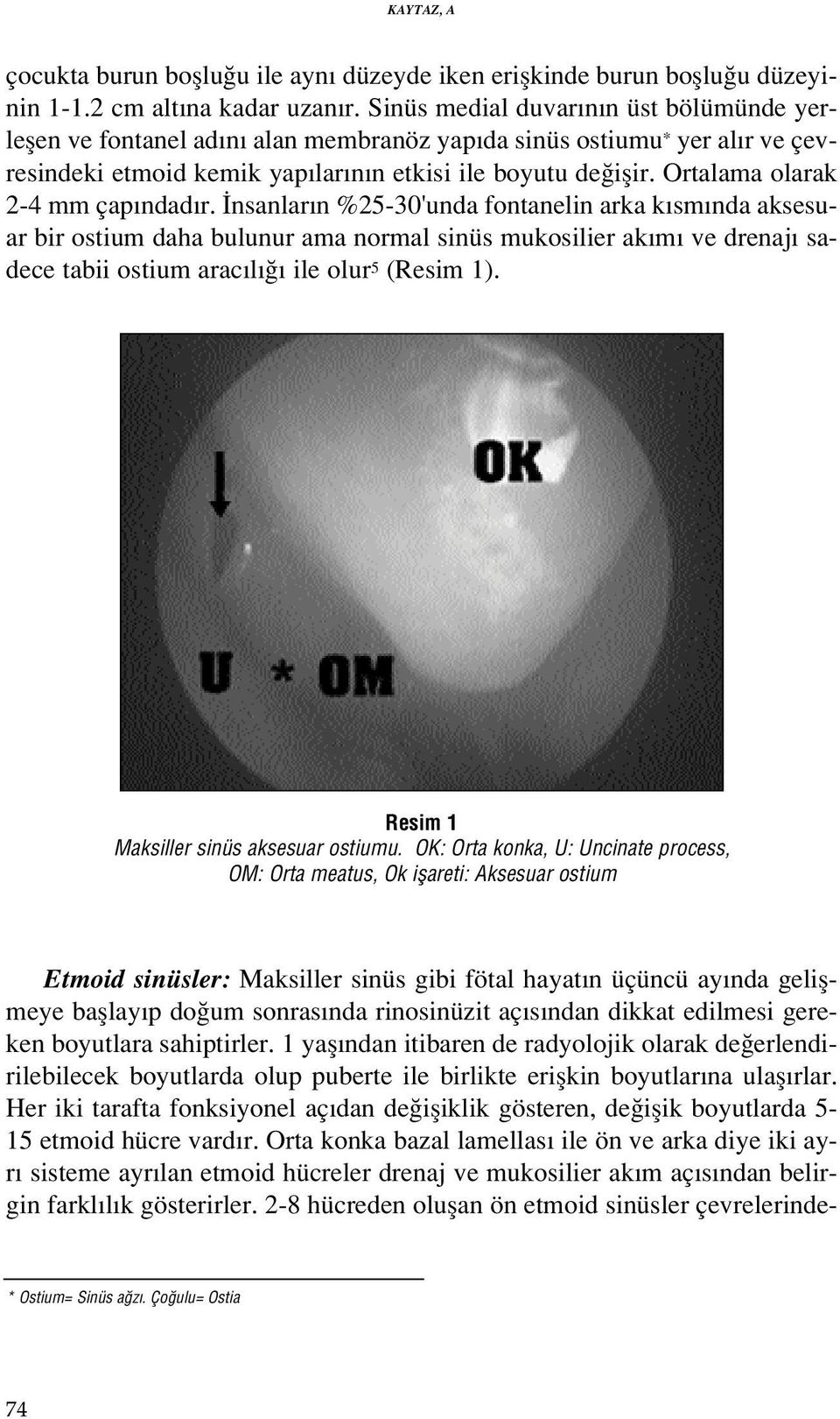 Ortalama olarak 2-4 mm çap ndad r.