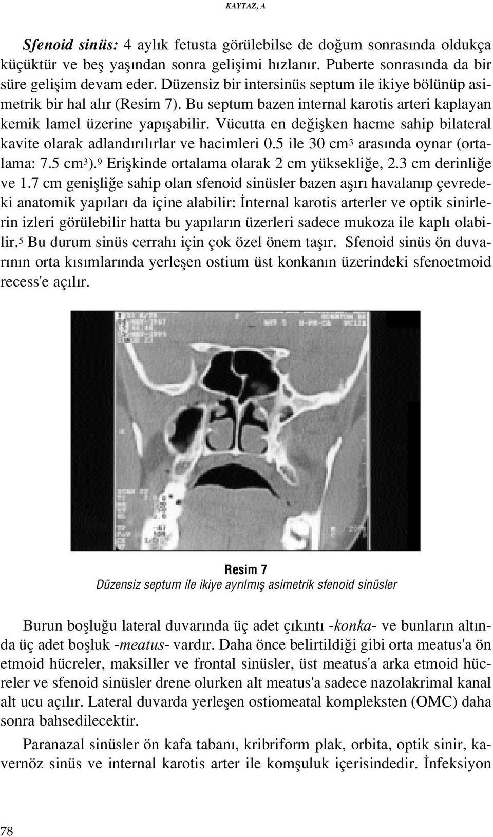 Vücutta en de iflken hacme sahip bilateral kavite olarak adland r l rlar ve hacimleri 0.5 ile 30 cm 3 aras nda oynar (ortalama: 7.5 cm 3 ). 9 Eriflkinde ortalama olarak 2 cm yüksekli e, 2.