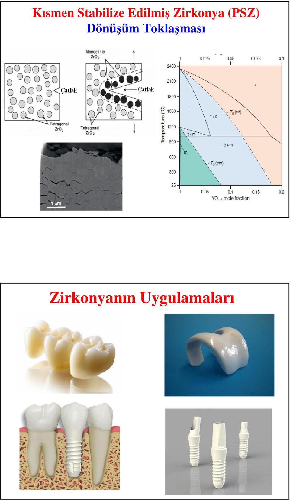 (PSZ) Dönüşüm