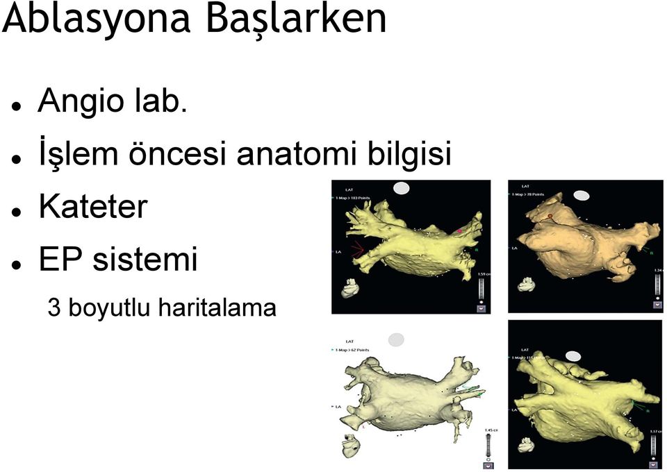 İşlem öncesi anatomi