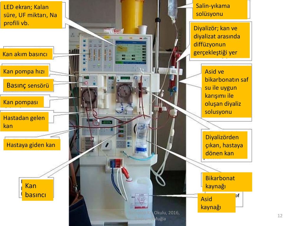 gerçekleştiği yer Kan pompa hızı oru Basınç sensörü Kan pompası Hastadan gelen kan Asid ve