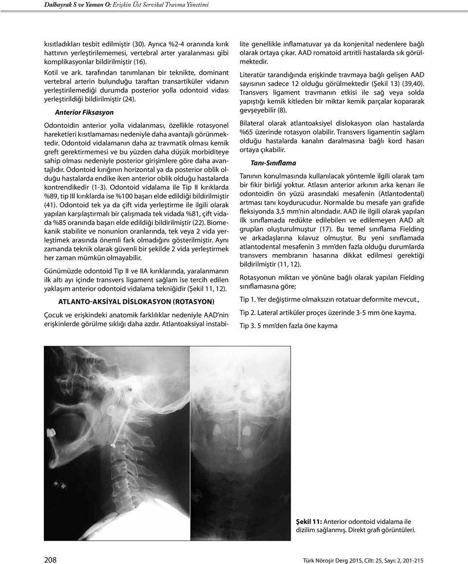 Anterior Fiksasyon Odontoidin anterior yolla vidalanması, özellikle rotasyonel hareketleri kısıtlamaması nedeniyle daha avantajlı görünmektedir.