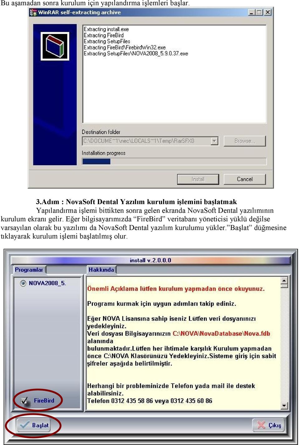 ekranda NovaSoft Dental yazılımının kurulum ekranı gelir.