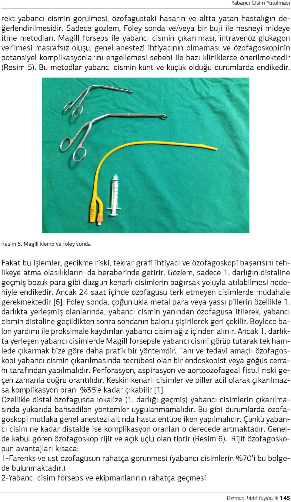 olmaması ve özofagoskopinin potansiyel komplikasyonlarını engellemesi sebebi ile bazı kliniklerce önerilmektedir (Resim 5). u metodlar yabancı cismin künt ve küçük olduğu durumlarda endikedir.