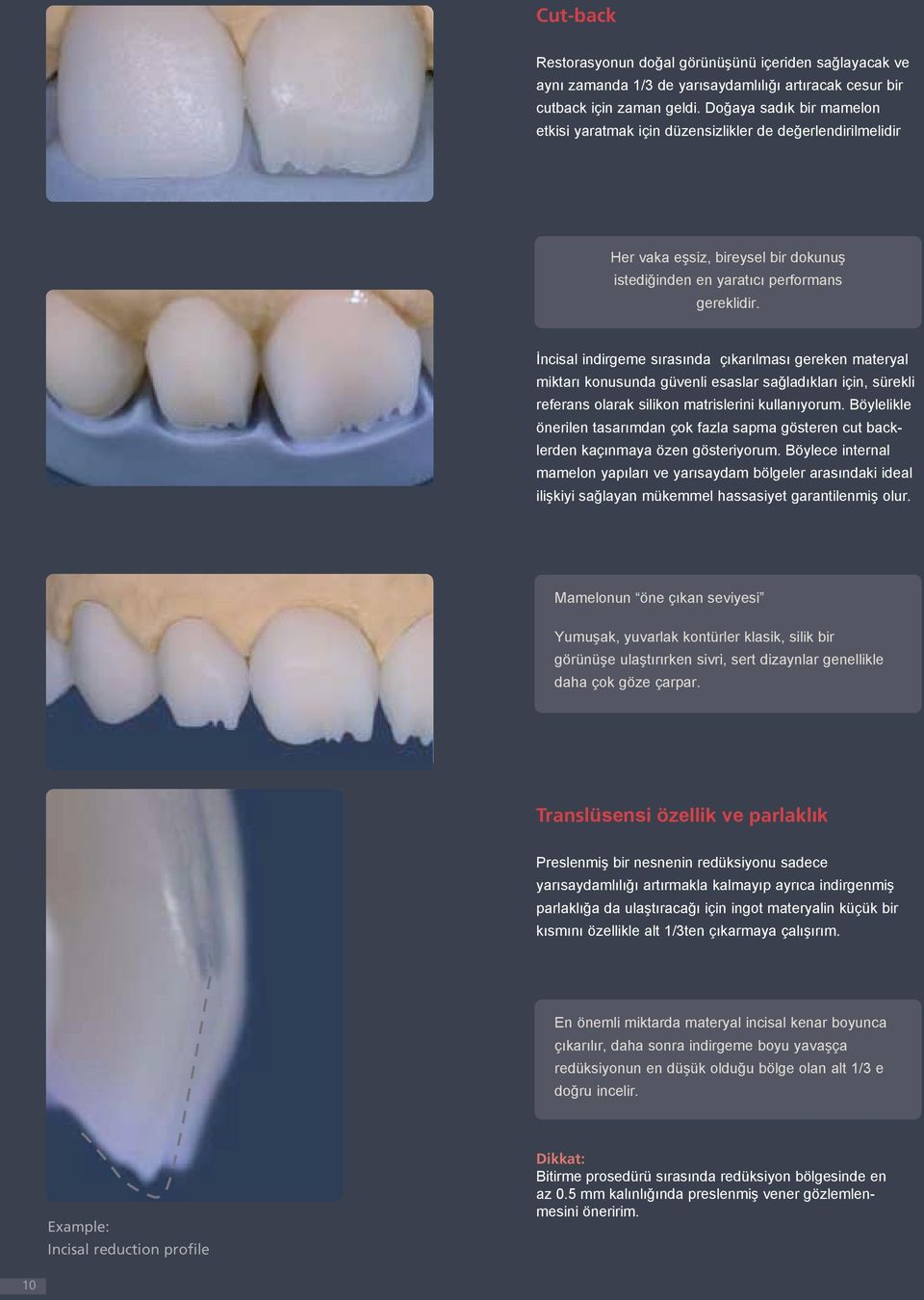 İncisal indirgeme sırasında çıkarılması gereken materyal miktarı konusunda güvenli esaslar sağladıkları için, sürekli referans olarak silikon matrislerini kullanıyorum.