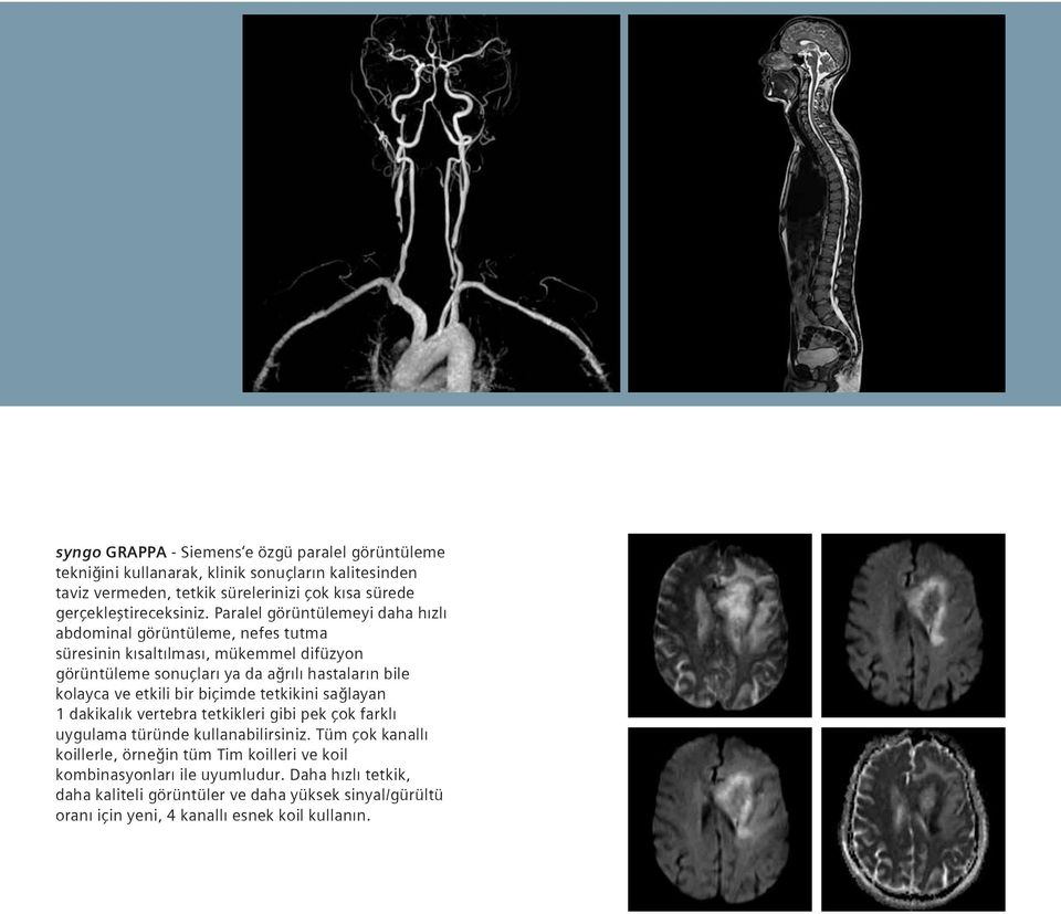 Paralel görüntülemeyi daha hızlı abdominal görüntüleme, nefes tutma süresinin kısaltılması, mükemmel difüzyon görüntüleme sonuçları ya da ağrılı hastaların bile kolayca ve