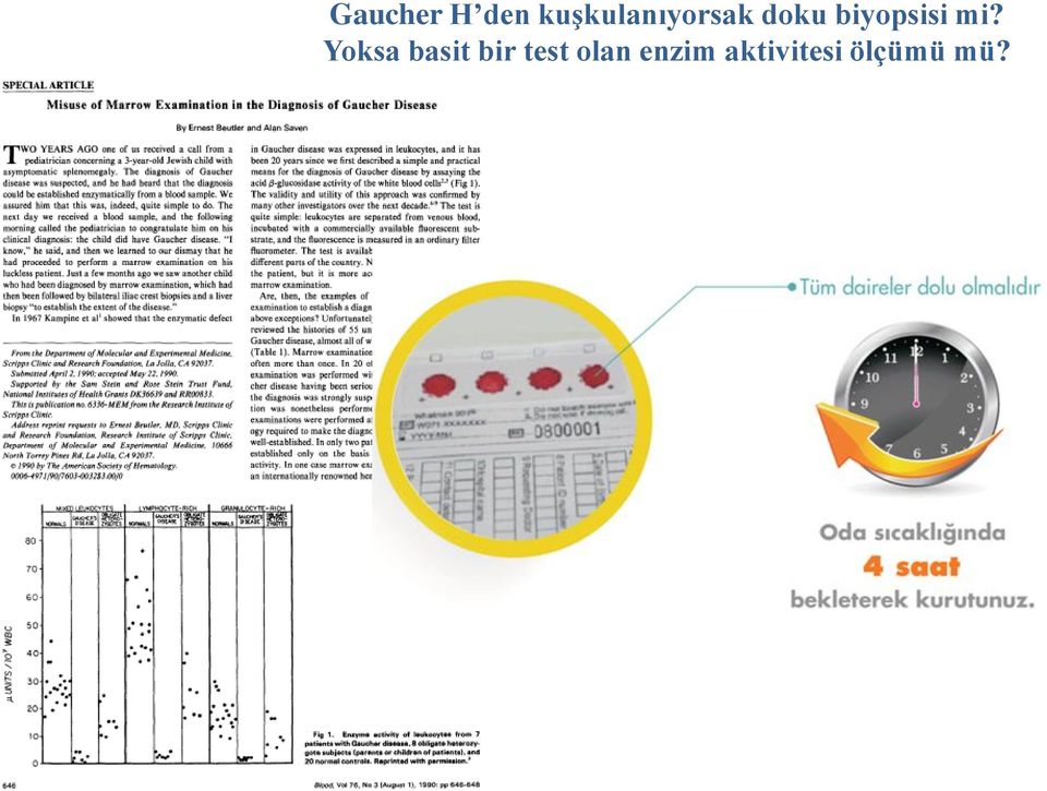 kuşkulanıyorsak doku