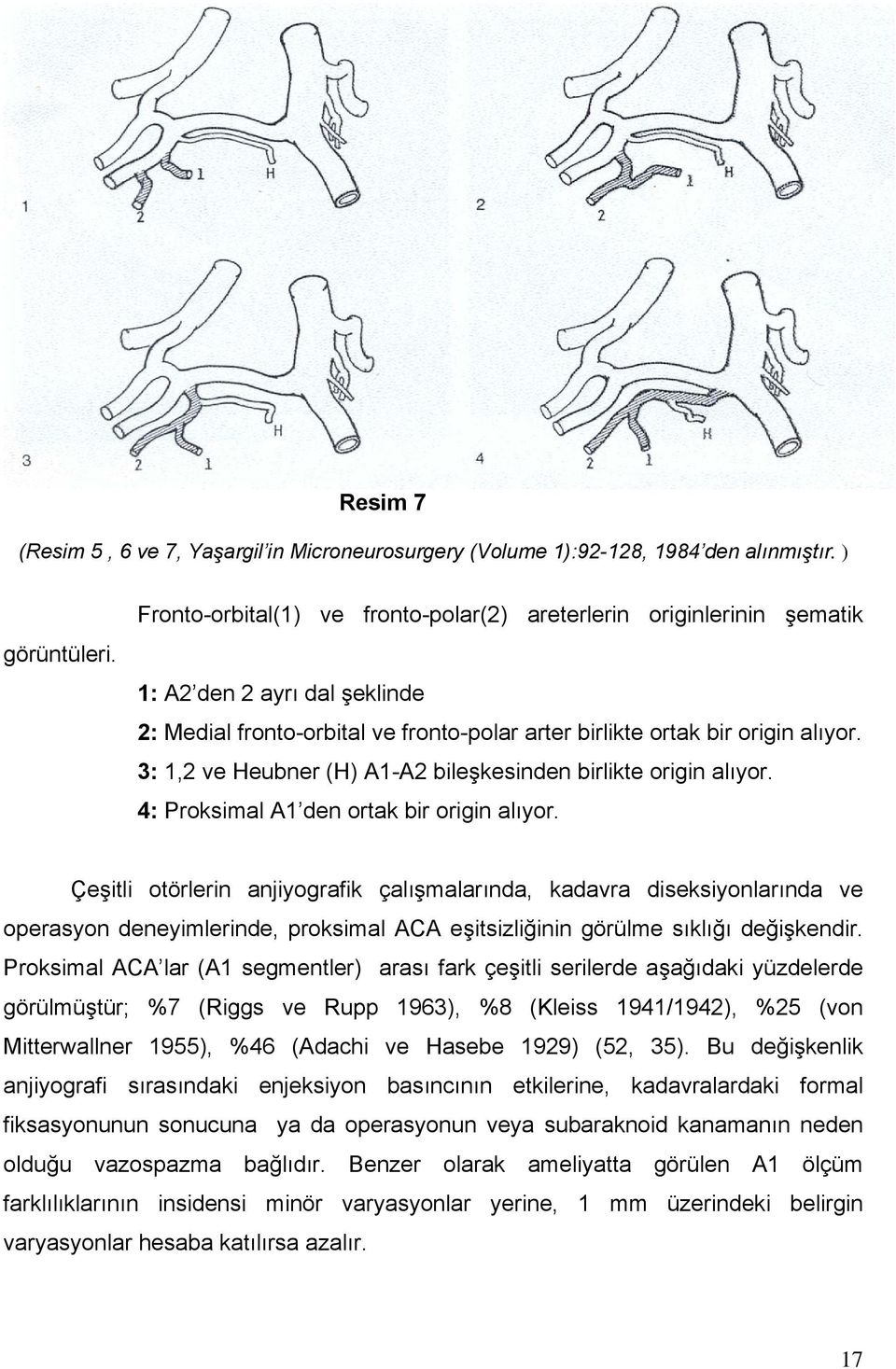 3: 1,2 ve Heubner (H) A1-A2 bileşkesinden birlikte origin alıyor. 4: Proksimal A1 den ortak bir origin alıyor.